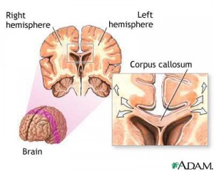 corpus-callosum-of-the-brain